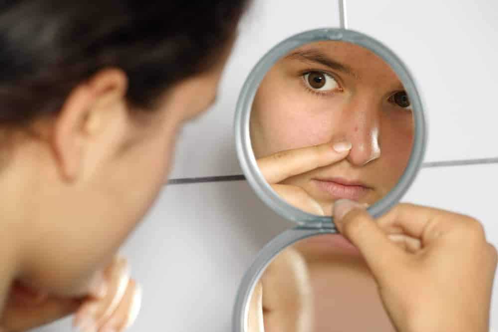The 6 Natural Supplements To Stop Hormonal Acne